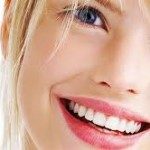 Clareamento Dental é seguro? Vale a pena?