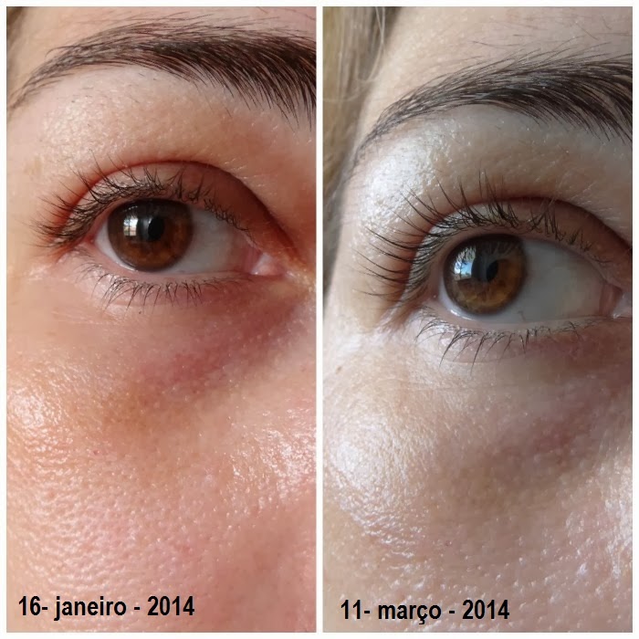 Vichy Liftactiv Serum 10 Olhos e Cìlios resenha antes e depois