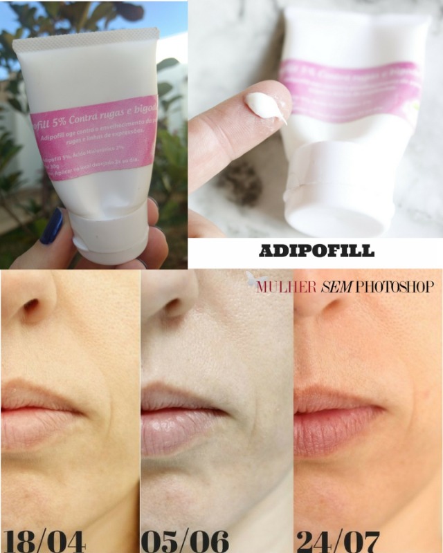 Adipofill Art Vitta - bigode chinês - antes e depois