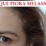 6 coisas que pioram MELASMA – mesmo que você esteja tratando!