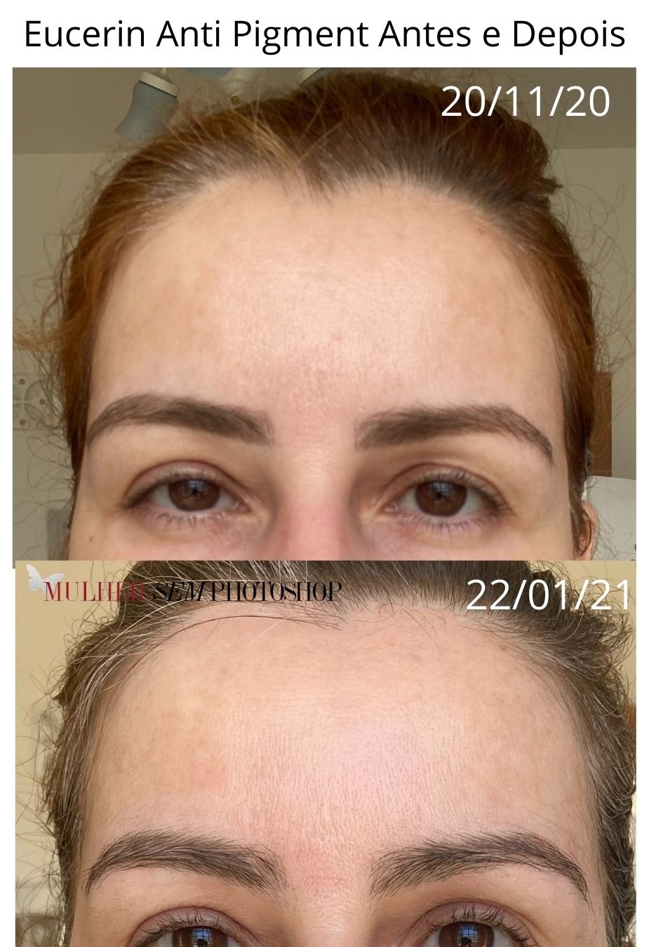 Mulher Sem Photoshop Arquivos Eucerin Anti Pigment Dual Serum Dia mulher-sem-photoshop-arquivos-eucerin-anti-pigment-dual-serum-dia